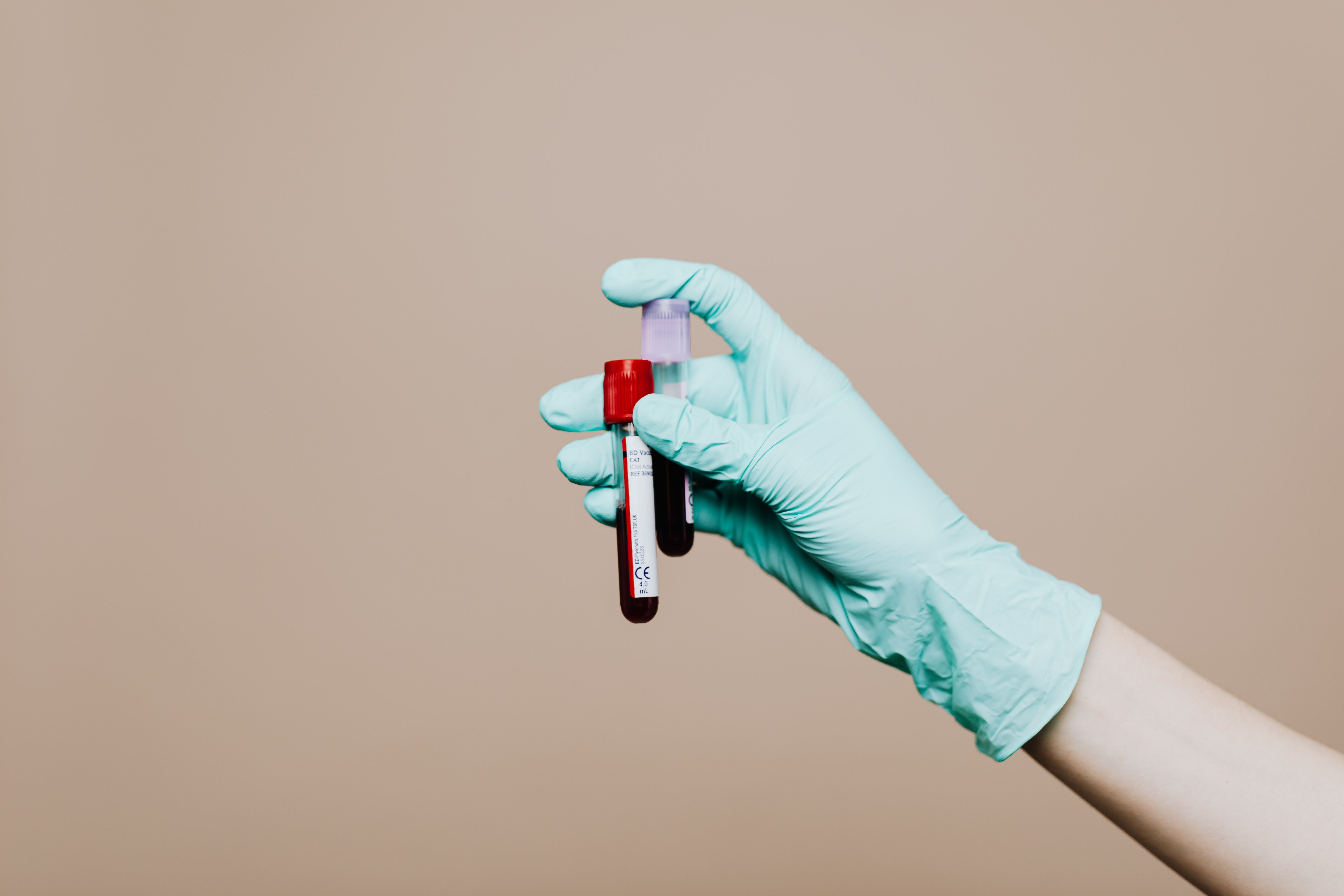 What Does a CBC Test Check For? Complete Guide